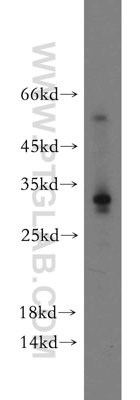 WB analysis of HepG2 using 21558-1-AP