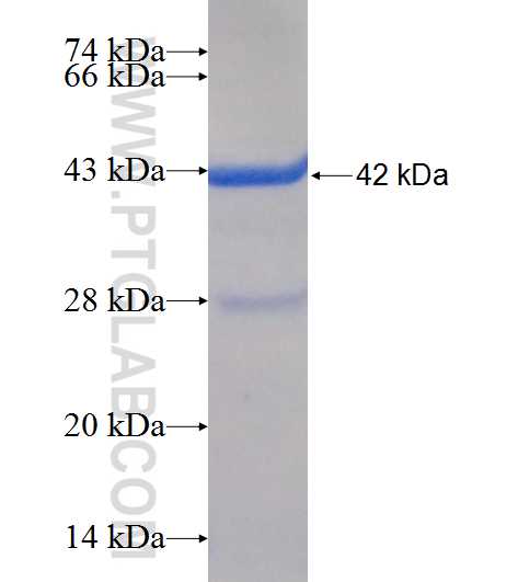 CCDC8 fusion protein Ag25794 SDS-PAGE