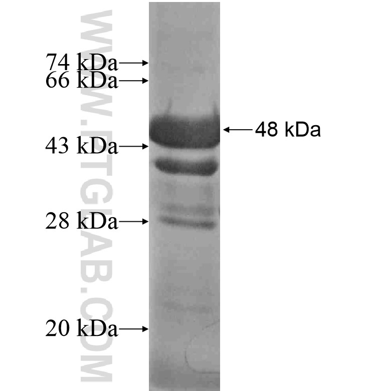 CCDC80 fusion protein Ag16699 SDS-PAGE CCDC80 fusion protein Ag16699 SDS-PAGE