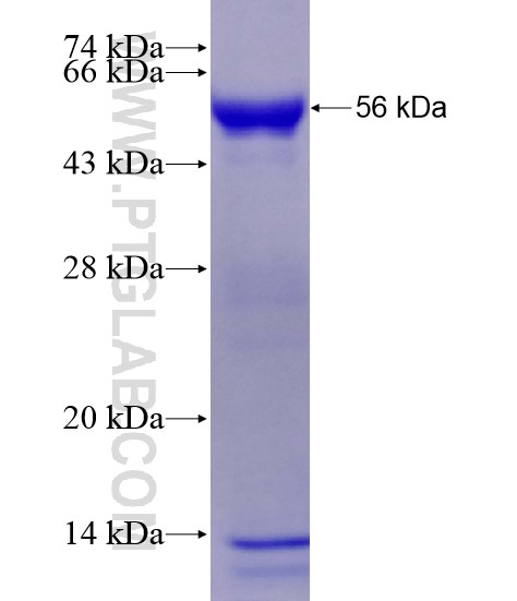 CCDC83 fusion protein Ag28480 SDS-PAGE