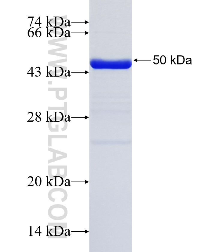 CCDC85C fusion protein Ag35157 SDS-PAGE CCDC85C fusion protein Ag35157 SDS-PAGE