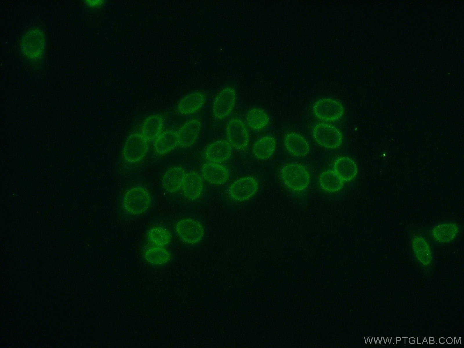 IF Staining of HepG2 using 14947-1-AP