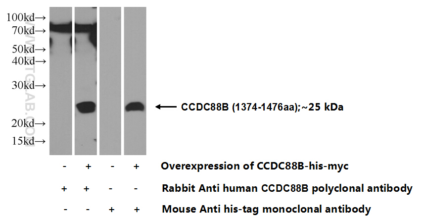 CCDC88B