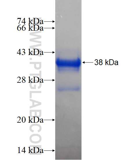 CCDC9 fusion protein Ag15374 SDS-PAGE CCDC9 fusion protein Ag15374 SDS-PAGE