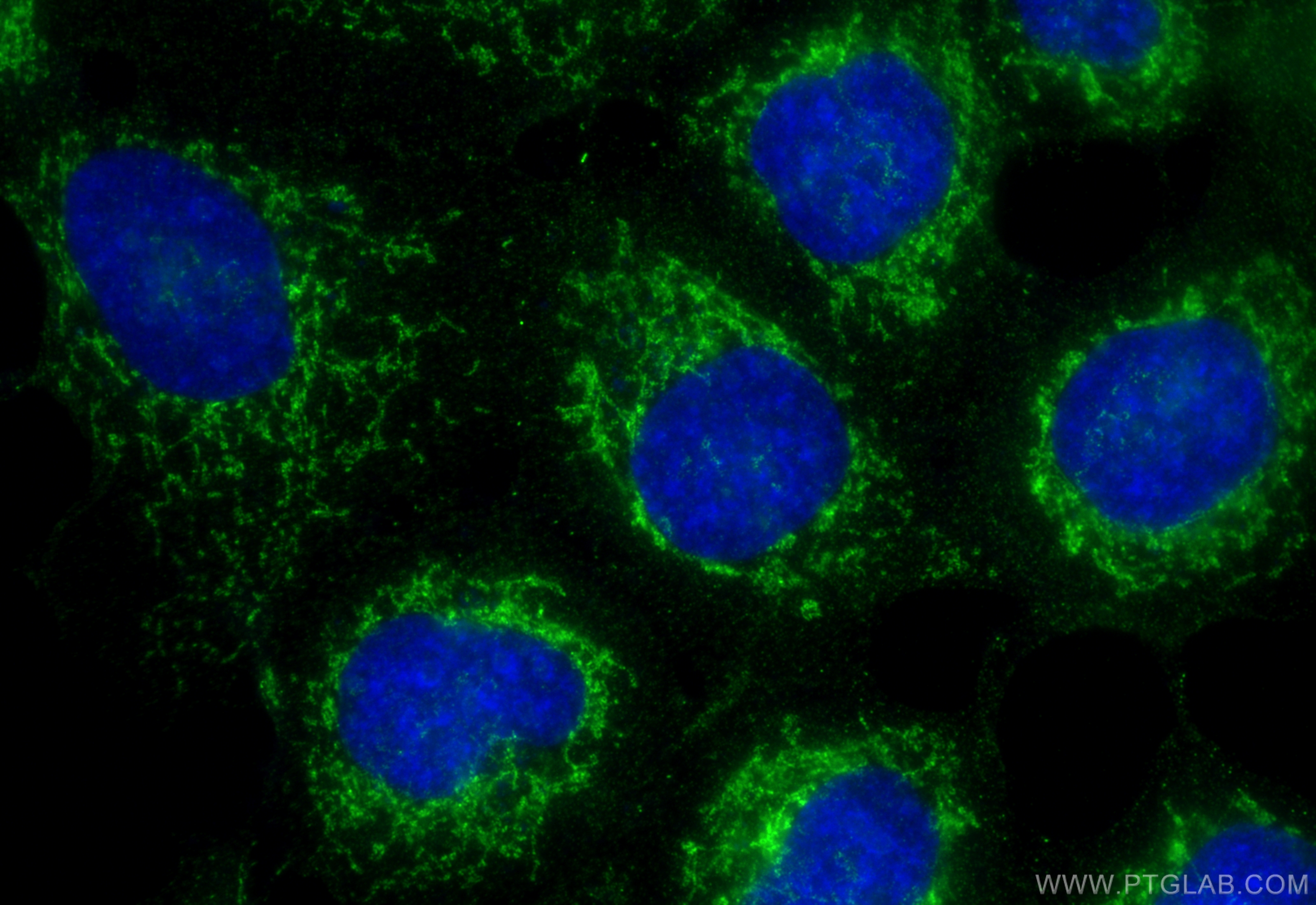 IF Staining of A431 using 27126-1-AP (same clone as 27126-1-PBS)