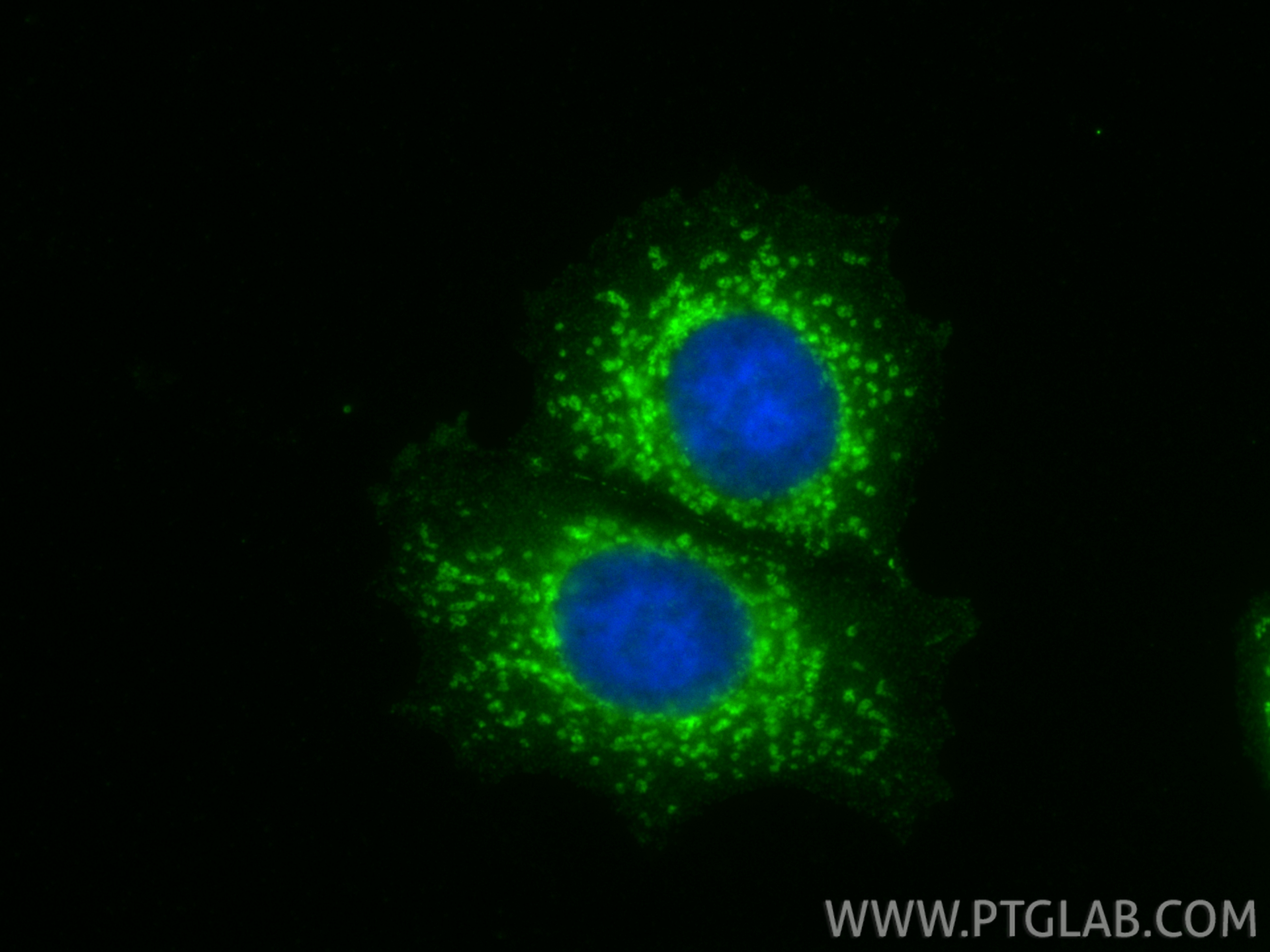 IF Staining of MCF-7 using 27126-1-AP (same clone as 27126-1-PBS)