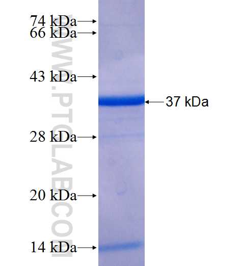CCDC90B fusion protein Ag25934 SDS-PAGE CCDC90B fusion protein Ag25934 SDS-PAGE