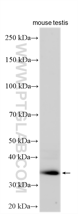 mouse testis tissue was subjected to SDS PAGE followed by western blot with 27192-1-AP (CCDC92 antibody) at dilution of 1:1000 incubated at room temperature for 1.5 hours. WB analysis using 27192-1-AP