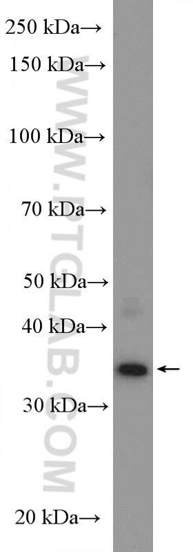 WB analysis of rat testis using 27192-1-AP