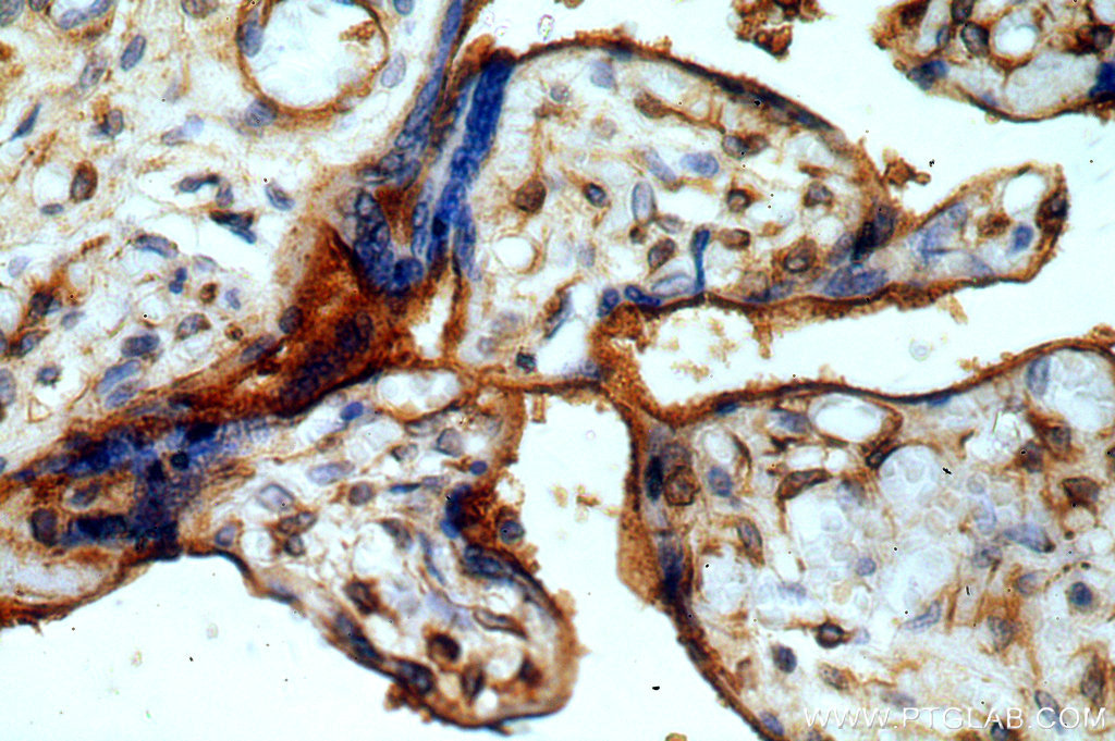 IHC staining of human placenta using 19431-1-AP