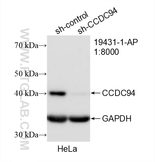 WB analysis of HeLa using 19431-1-AP