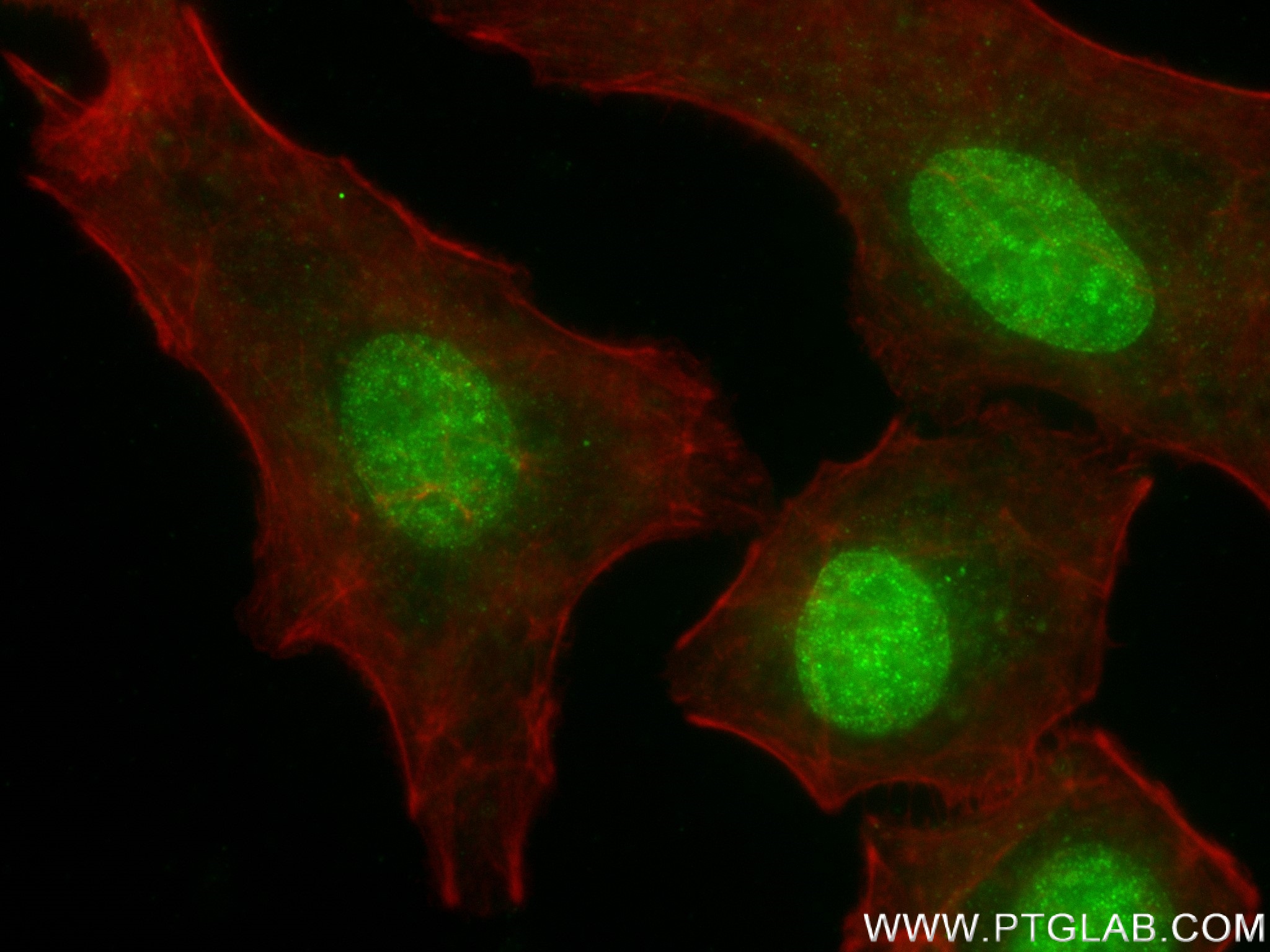 IF Staining of A549 using 83580-5-RR (same clone as 83580-5-PBS)