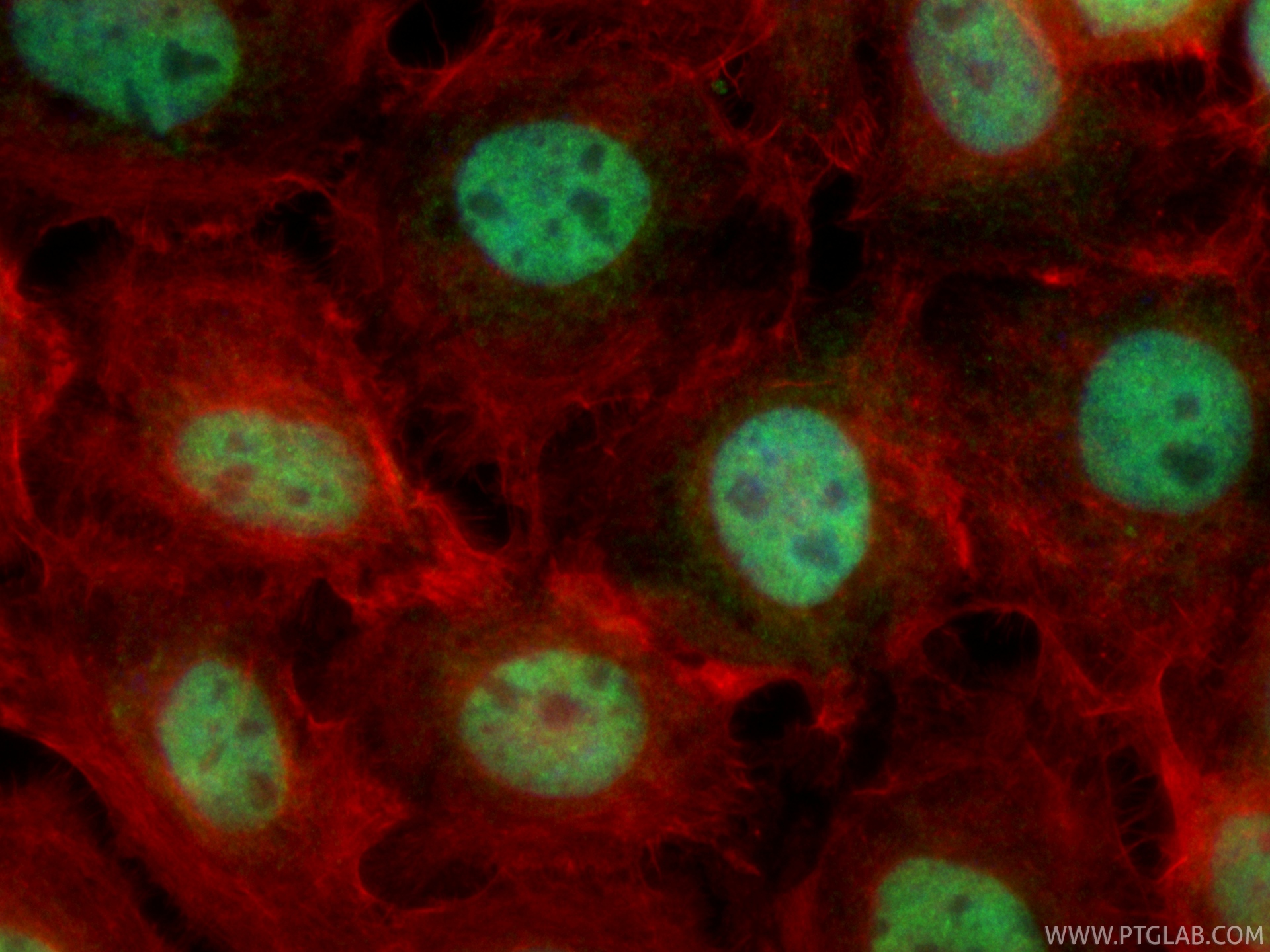 Immunofluorescent analysis of (4% PFA) fixed A431 cells using CoraLite® Plus 488 CCDC94 antibody (CL488-83580, Clone: 240517A1 ) at dilution of 1:200, CL594-phalloidin (red). IF Staining of A431 using CL488-83580