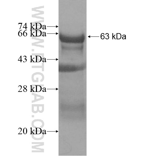 CCDC94 fusion protein Ag13764 SDS-PAGE