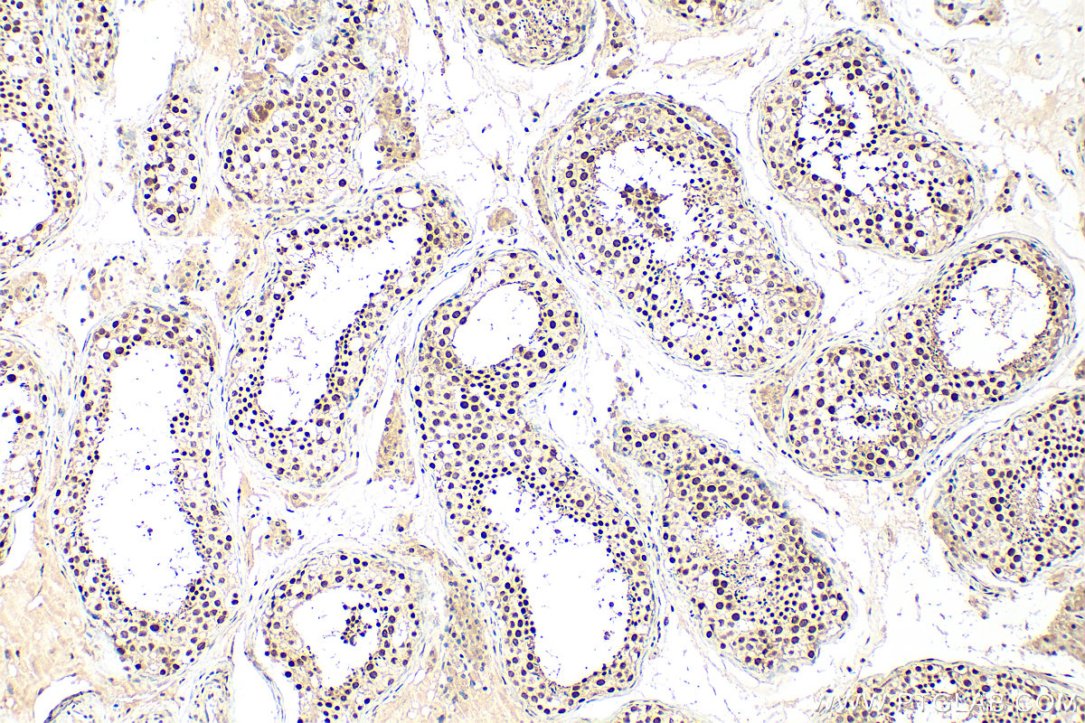 IHC staining of human testis using 31996-1-AP IHC staining of human testis using 31996-1-AP