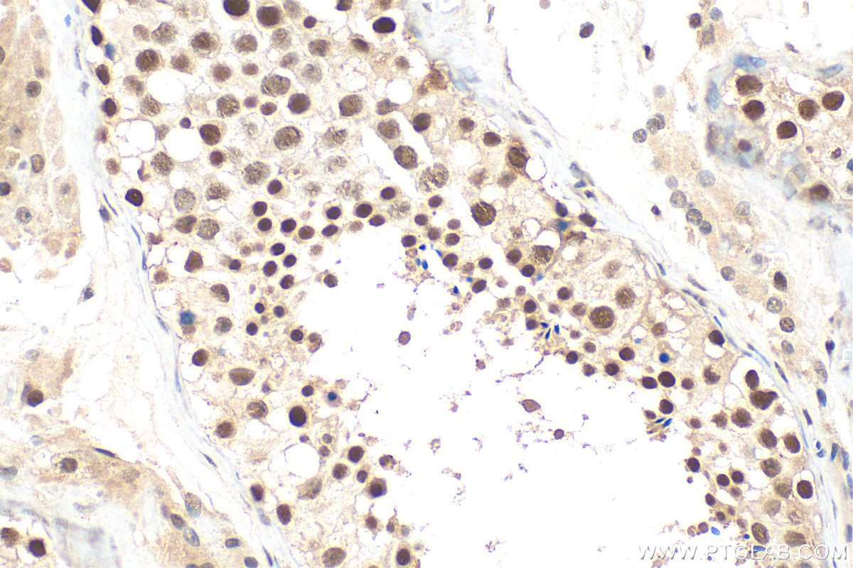 IHC staining of human testis using 31996-1-AP IHC staining of human testis using 31996-1-AP