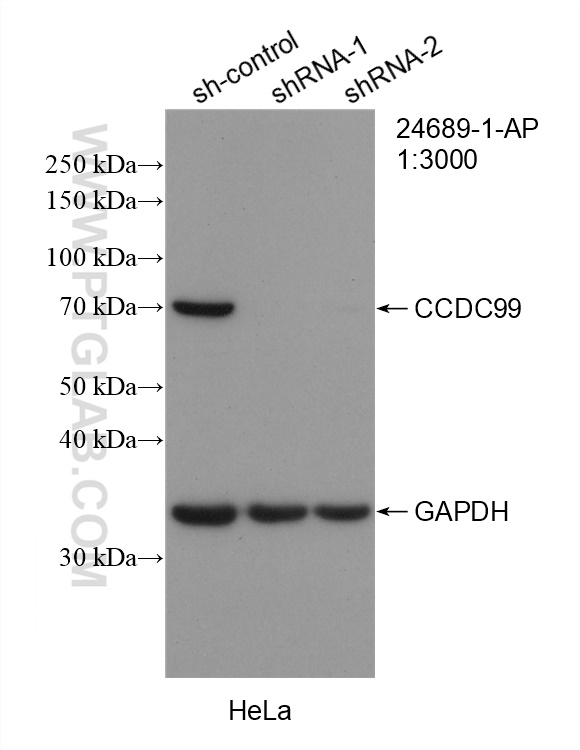 WB analysis of HeLa using 24689-1-AP