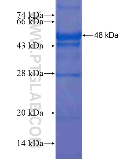 CCDC99 fusion protein Ag20439 SDS-PAGE CCDC99 fusion protein Ag20439 SDS-PAGE