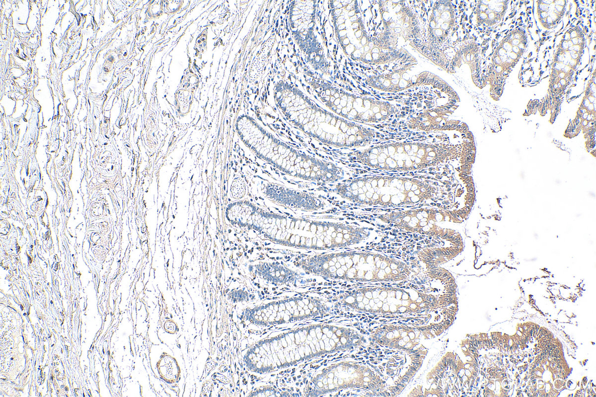 IHC staining of human colon using 21869-1-AP (same clone as 21869-1-PBS)
