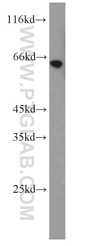 WB analysis of human testis using 13972-1-AP