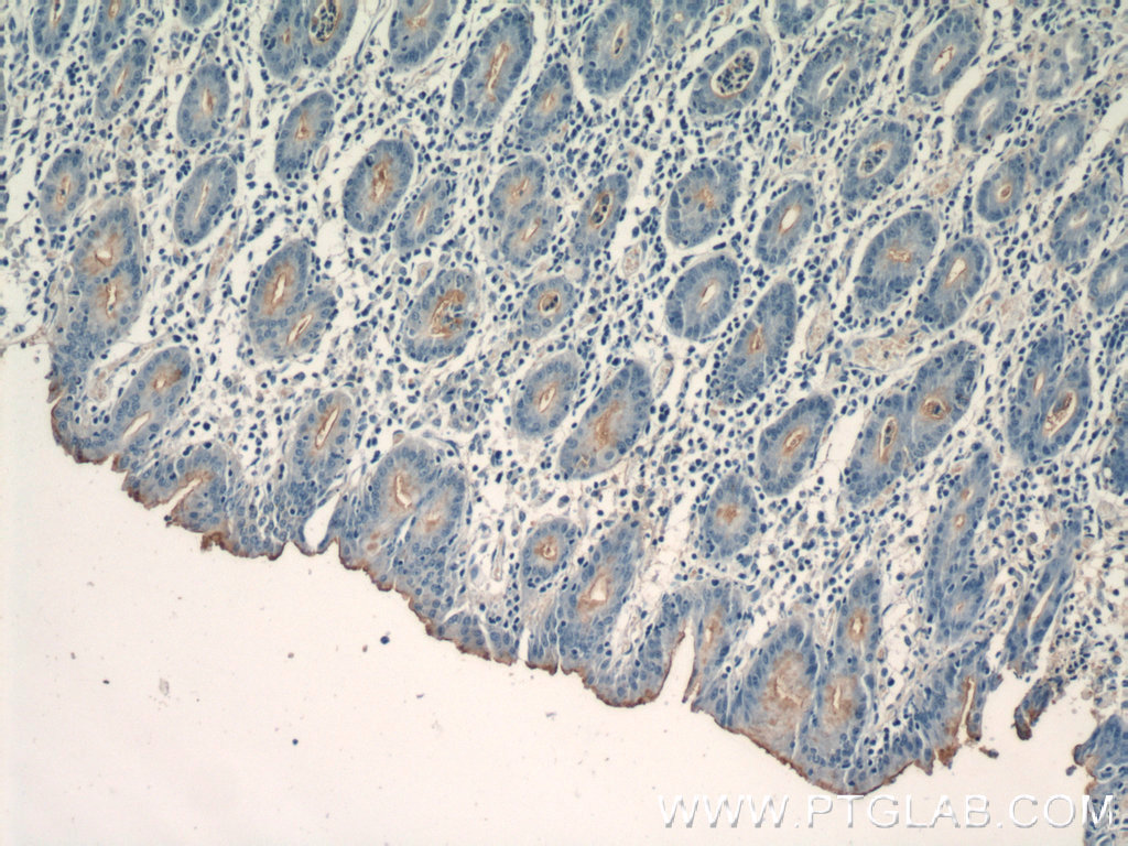 IHC staining of human stomach using 16550-1-AP