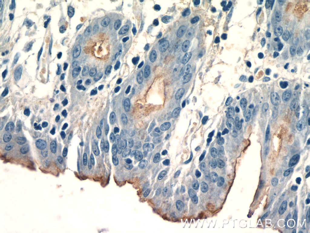 IHC staining of human stomach using 16550-1-AP