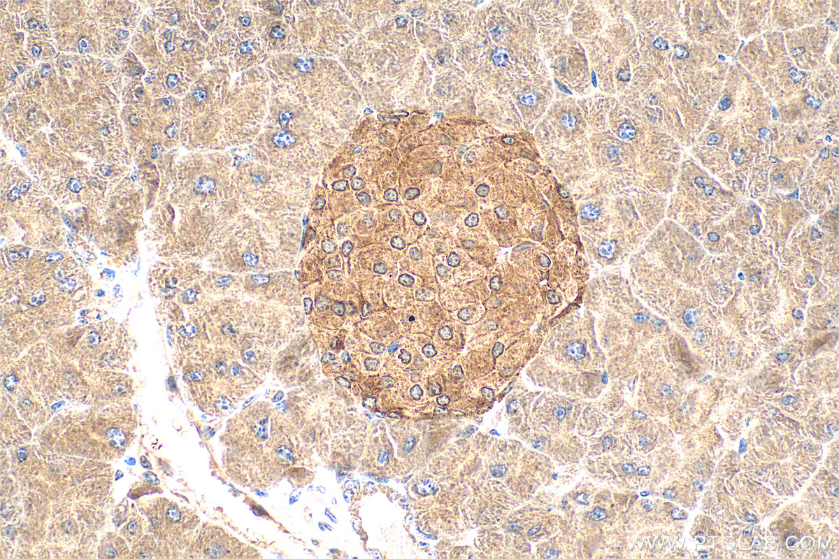 IHC staining of mouse pancreas using 16550-1-AP