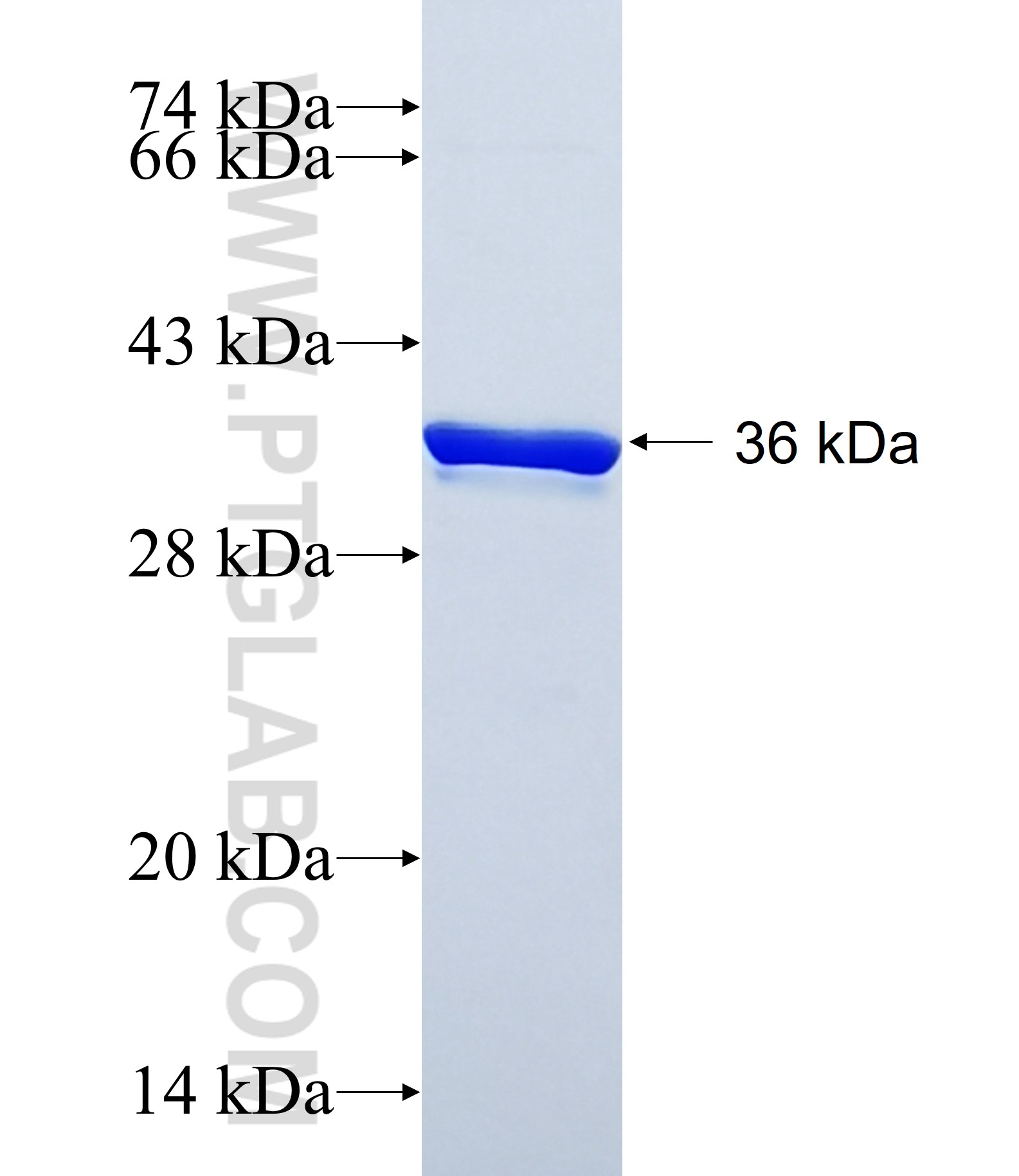 CCKBR fusion protein Ag39927 SDS-PAGE CCKBR fusion protein Ag39927 SDS-PAGE