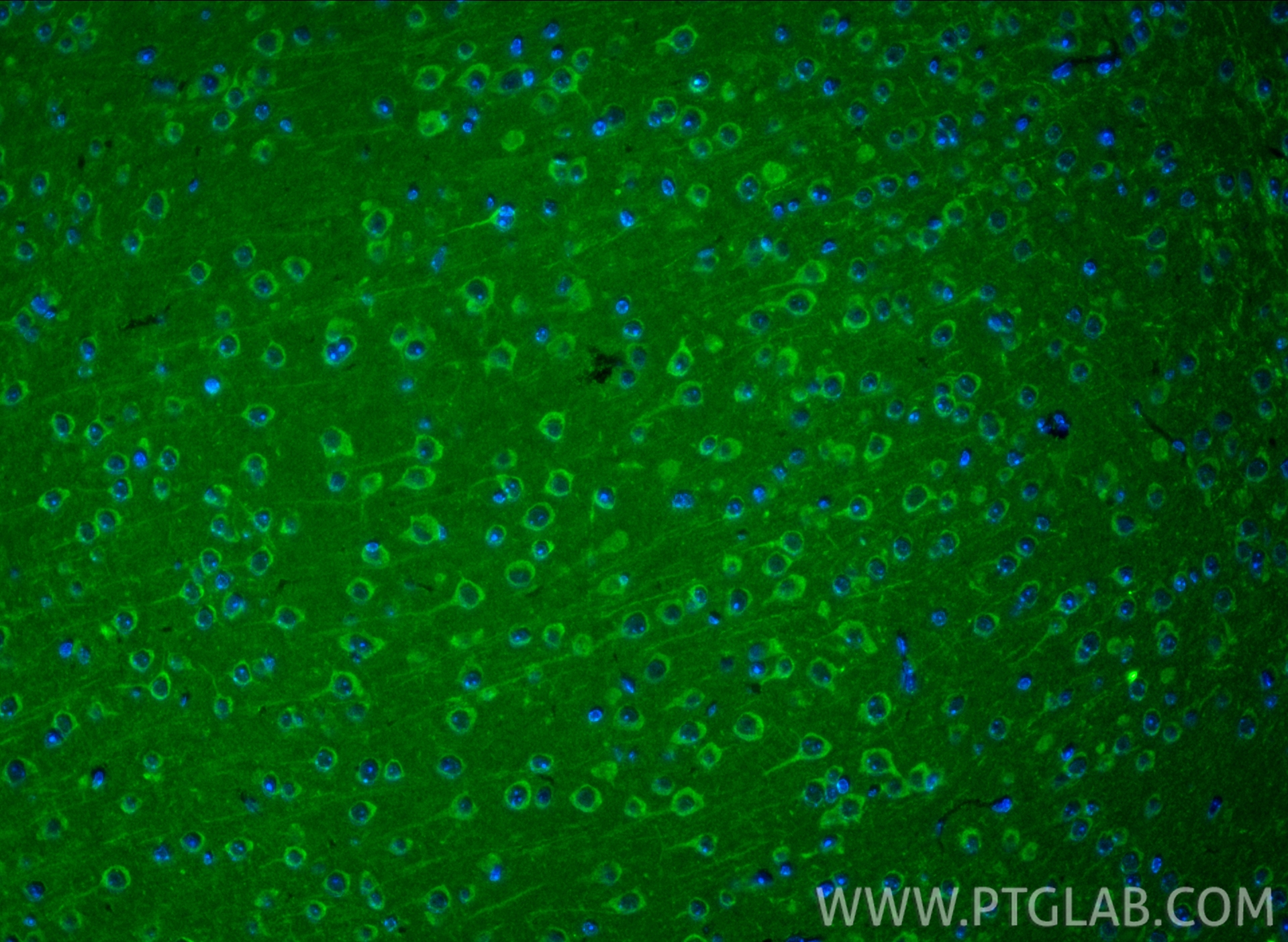 IF Staining of mouse brain using 16549-1-AP IF Staining of mouse brain using 16549-1-AP