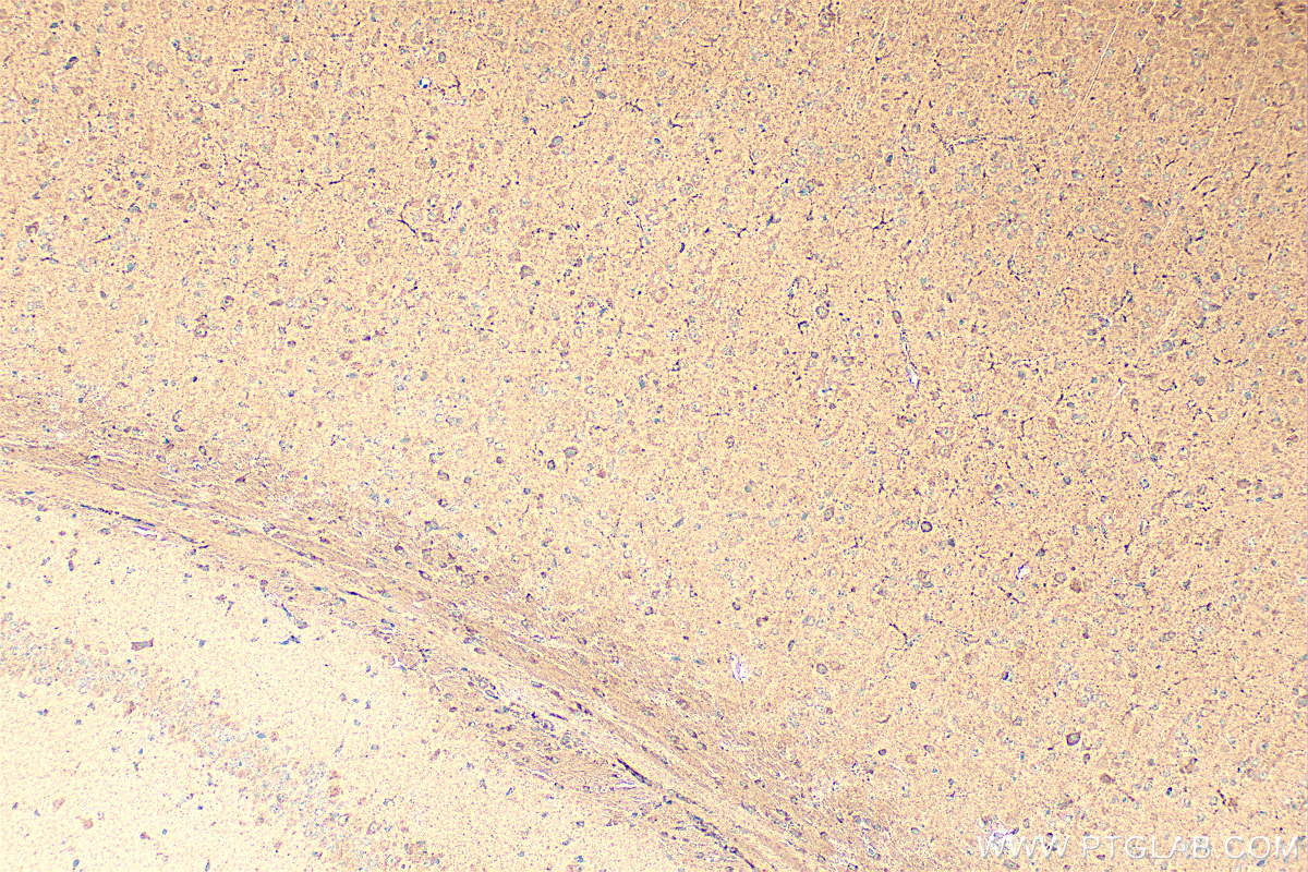 IHC staining of mouse brain using 16549-1-AP