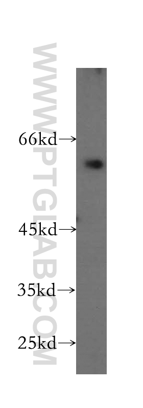 WB analysis of BxPC-3 using 16549-1-AP