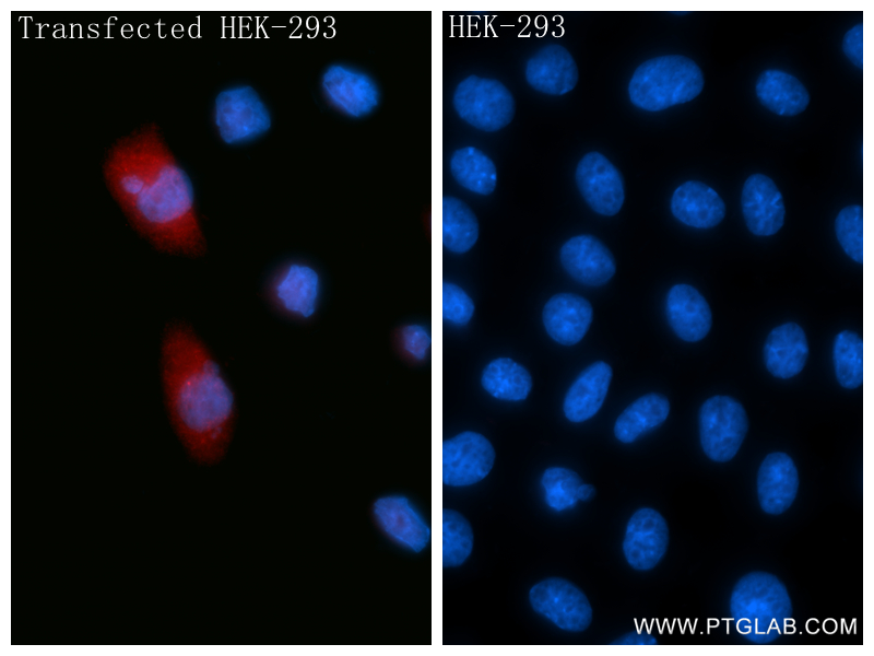 Immunofluorescent analysis of (4% PFA) fixed Transfected HEK-293 cells using CCL12/MCP-5 antibody (86565-1-RR, Clone: 250386A9 ) at dilution of 1:500 and CoraLite®488-Conjugated Goat Anti-Rabbit IgG(H+L) (<a class='green' href='/productredirect?CatalogNo=SA00013-2' target='_blank'>SA00013-2</a>). IF Staining of Transfected HEK-293 using 86565-1-RR