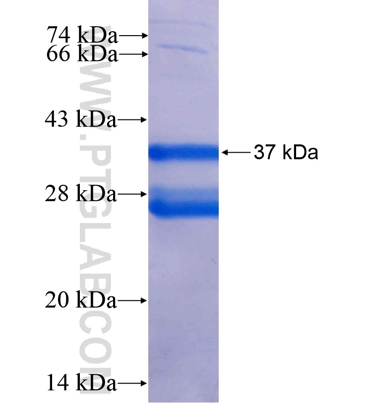 CCL16 fusion protein Ag16395 SDS-PAGE