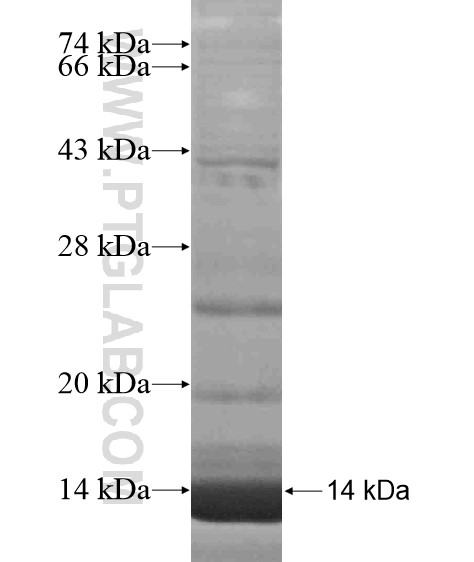 CCL17 fusion protein Ag19062 SDS-PAGE CCL17 fusion protein Ag19062 SDS-PAGE