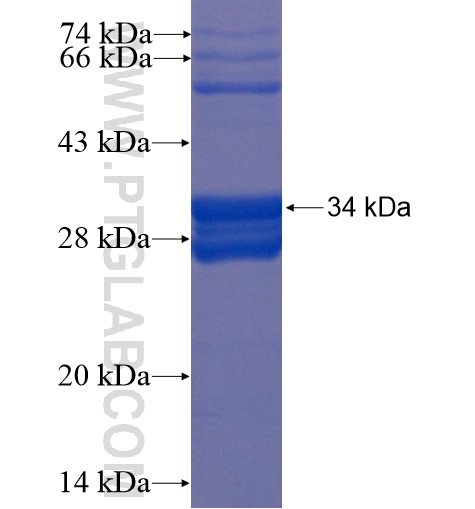 CCL18 fusion protein Ag12801 SDS-PAGE CCL18 fusion protein Ag12801 SDS-PAGE