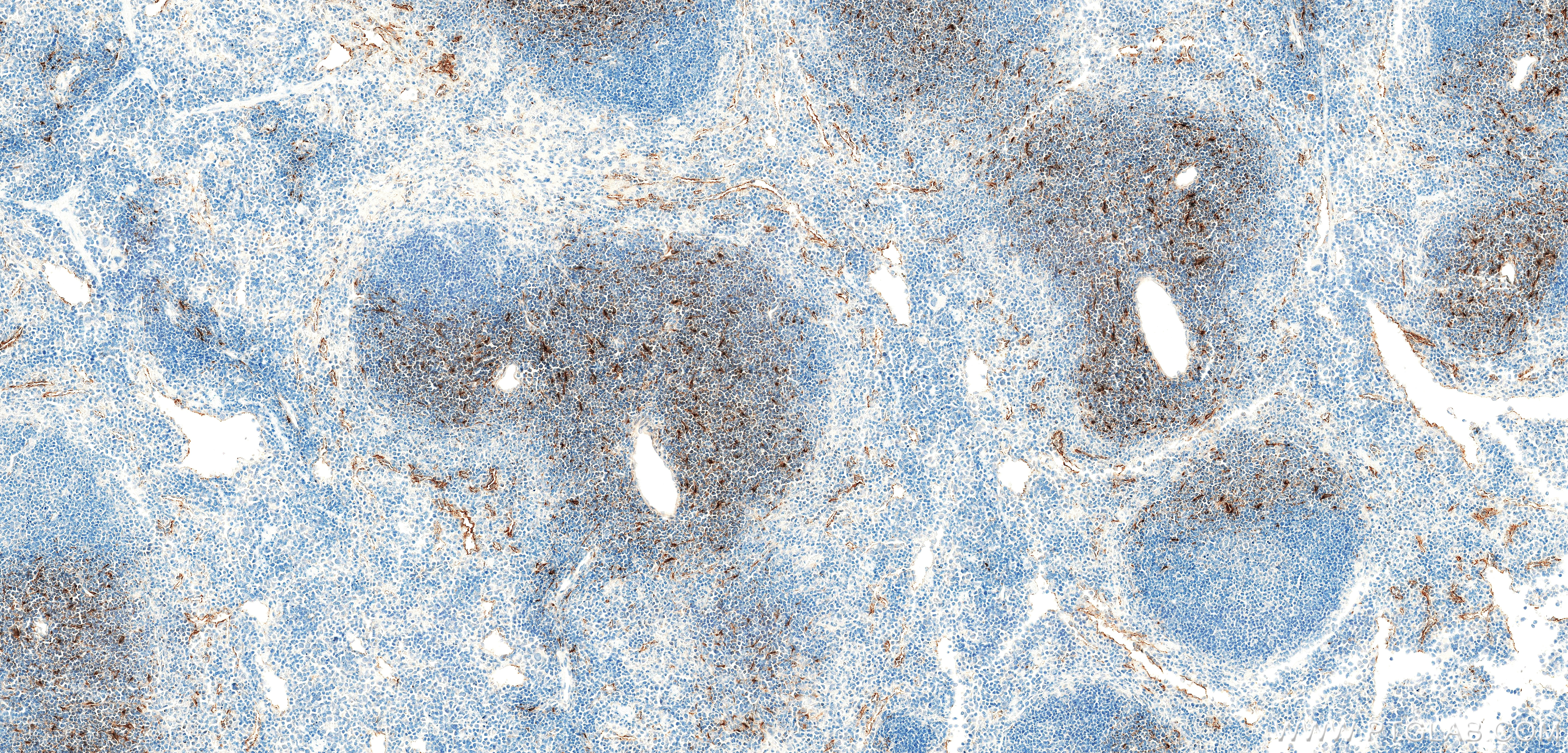 IHC staining of mouse spleen using 85861-1-RR (same clone as 85861-1-PBS)