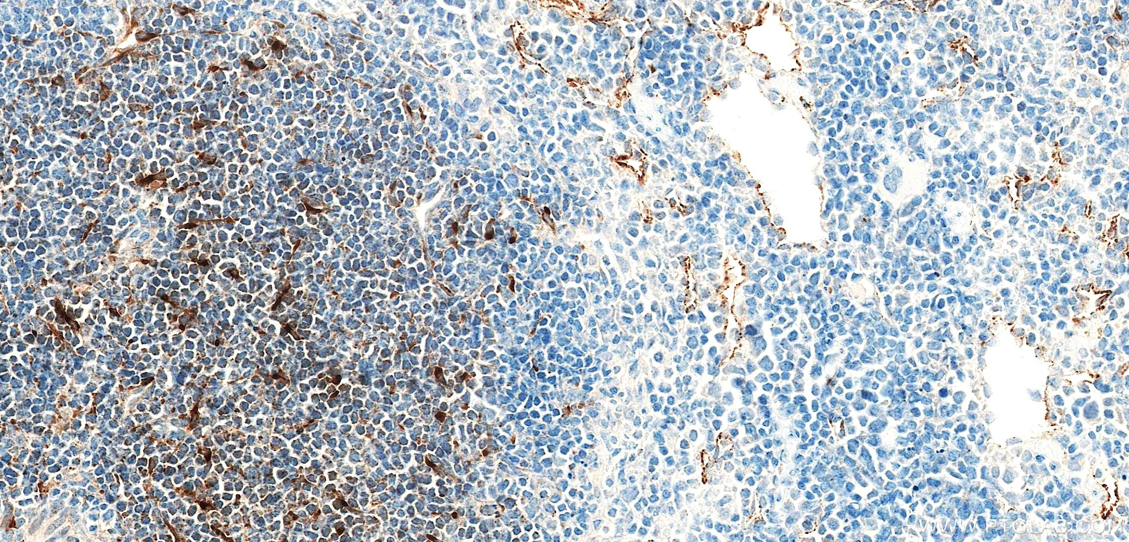IHC staining of mouse spleen using 85861-1-RR (same clone as 85861-1-PBS)
