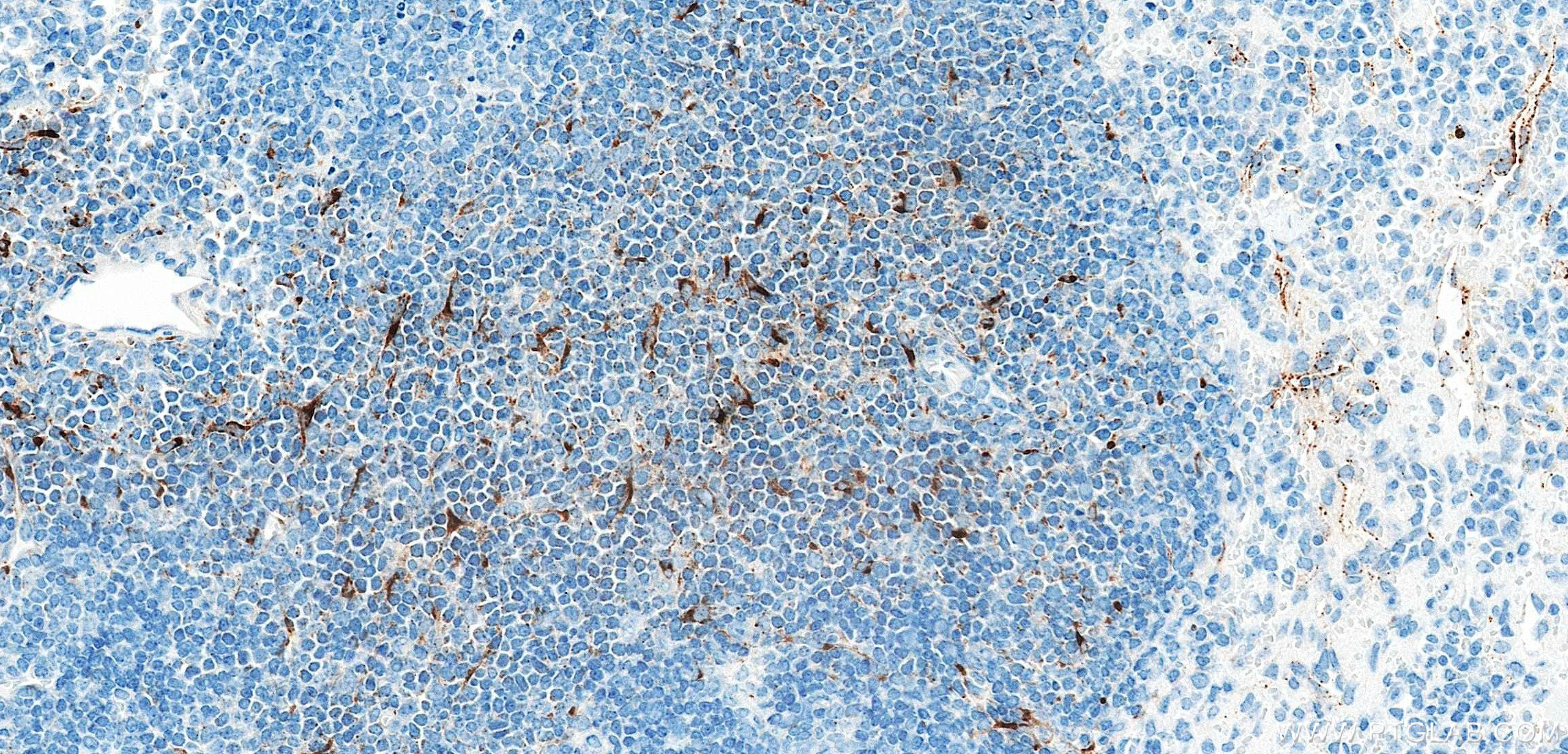 IHC staining of mouse spleen using 85861-1-RR (same clone as 85861-1-PBS) IHC staining of mouse spleen using 85861-1-RR (same clone as 85861-1-PBS)