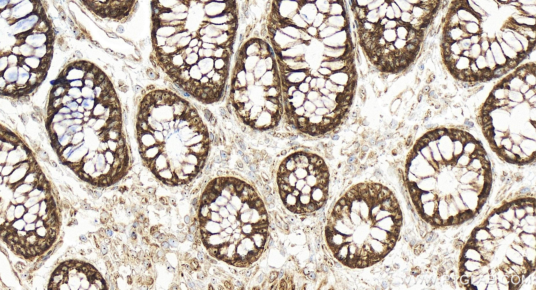 IHC staining of human colon using 84413-3-RR