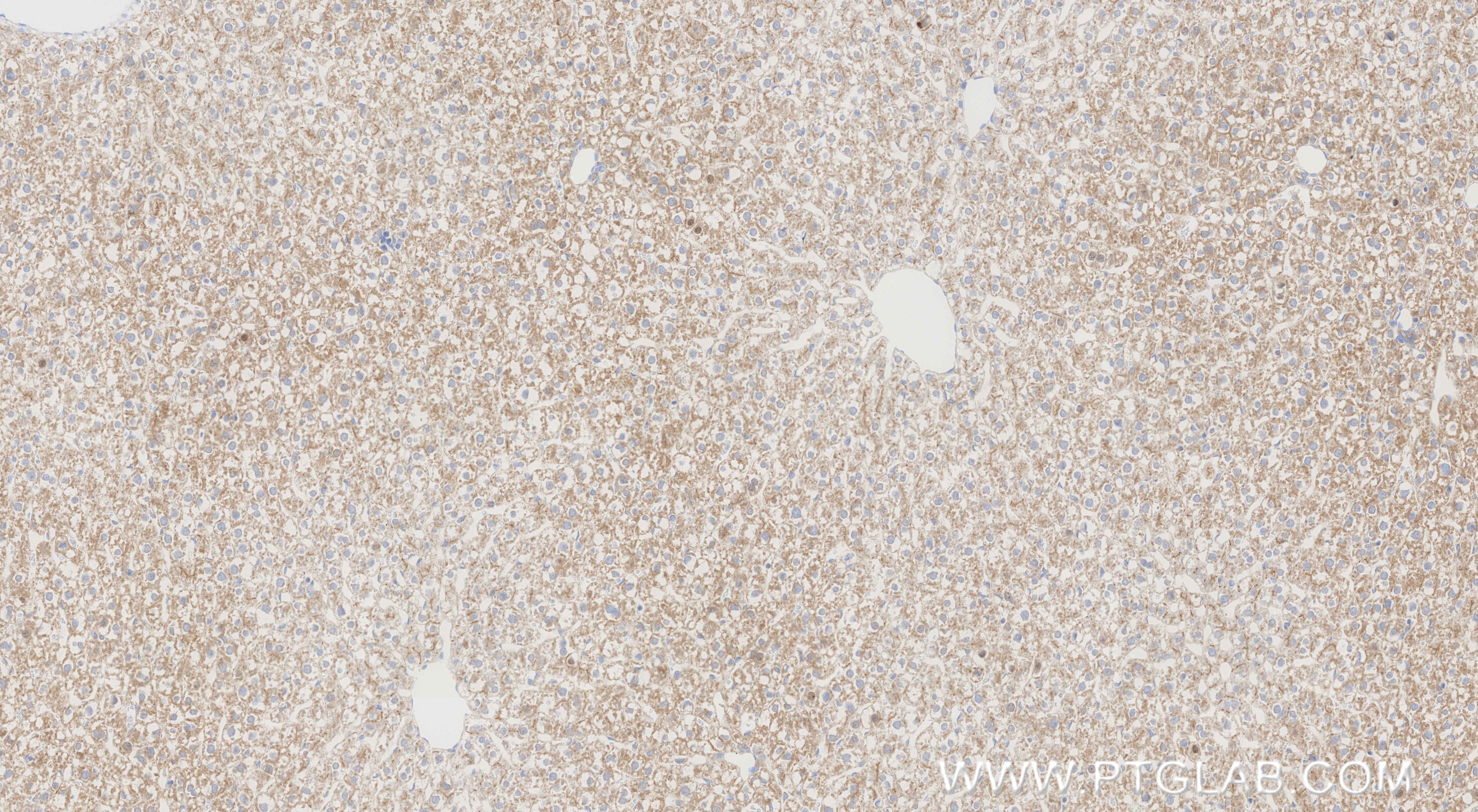 Immunohistochemical analysis of paraffin-embedded rat liver tissue slide using <a class='green' href='/productredirect?CatalogNo=86607-3-RR' target='_blank'>86607-3-RR</a> (CCL20/MIP-3 alpha antibody) at dilution of 1:1000 (under 10x lens). Heat mediated antigen retrieval with Tris-EDTA buffer (pH 9.0). This data was developed using the same antibody clone with 86607-3-PBS in a different storage buffer formulation. IHC staining of rat liver using 86607-3-RR (same clone as 86607-3-PBS)