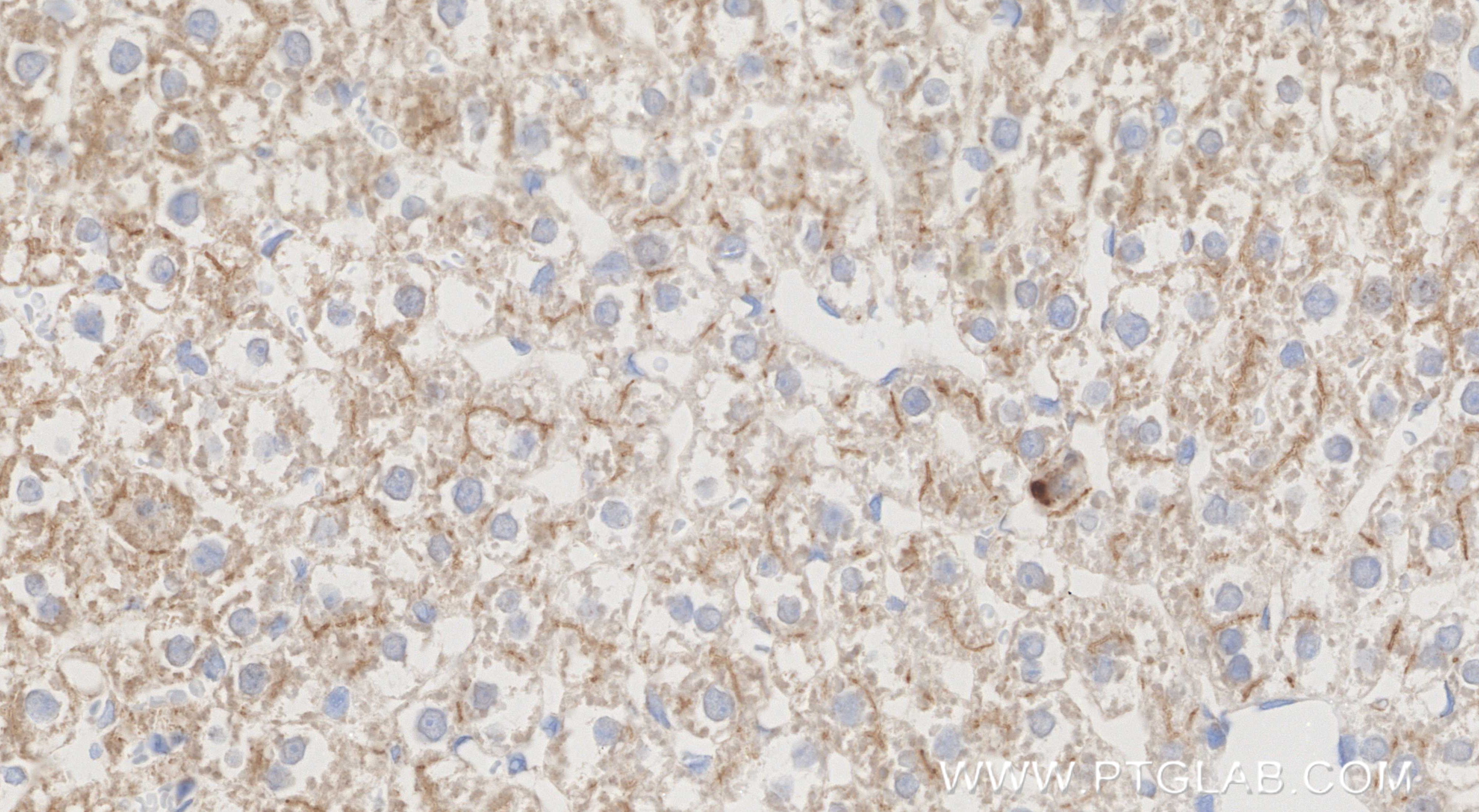 Immunohistochemical analysis of paraffin-embedded rat liver tissue slide using <a class='green' href='/productredirect?CatalogNo=86607-3-RR' target='_blank'>86607-3-RR</a> (CCL20/MIP-3 alpha antibody) at dilution of 1:1000 (under 40x lens). Heat mediated antigen retrieval with Tris-EDTA buffer (pH 9.0). This data was developed using the same antibody clone with 86607-3-PBS in a different storage buffer formulation. IHC staining of rat liver using 86607-3-RR (same clone as 86607-3-PBS)