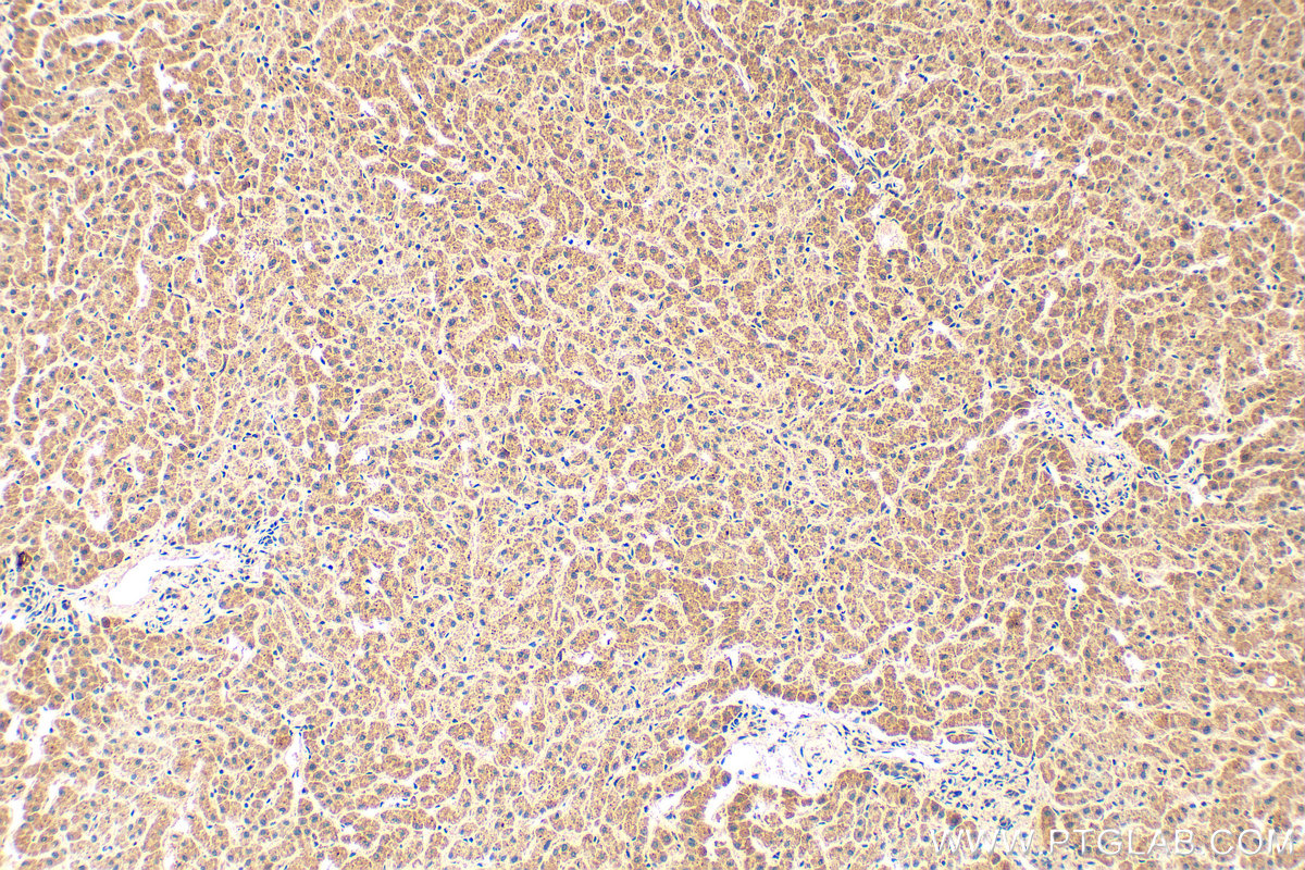 IHC staining of human liver using 17865-1-AP