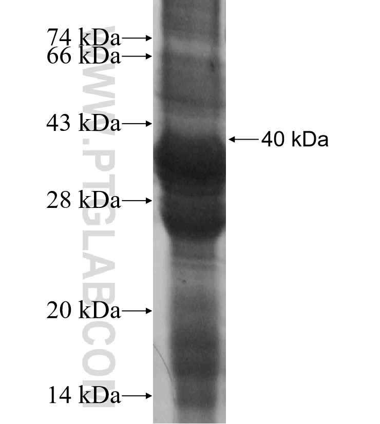 CCL25 fusion protein Ag17994 SDS-PAGE