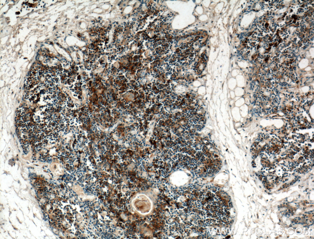 IHC staining of human thymus using 25285-1-AP