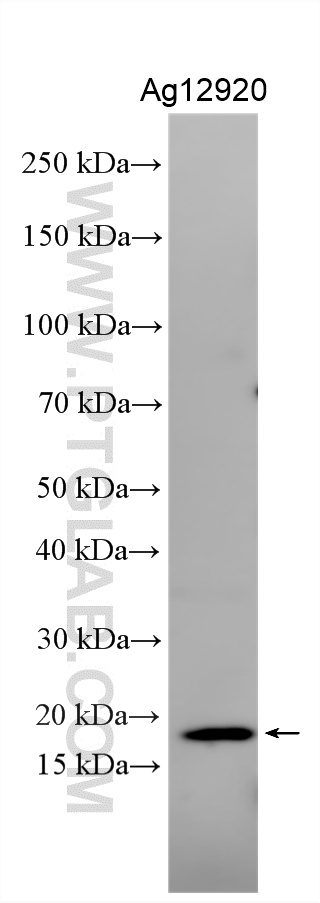 Recombinant protein were subjected to SDS PAGE followed by western blot with 18214-1-AP (CCL28 antibody) at dilution of 1:2000 incubated at room temperature for 1.5 hours. WB analysis using 18214-1-AP