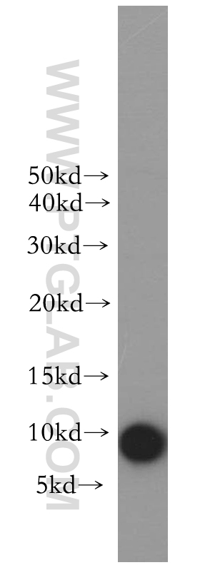 WB analysis of human spleen using 18214-1-AP