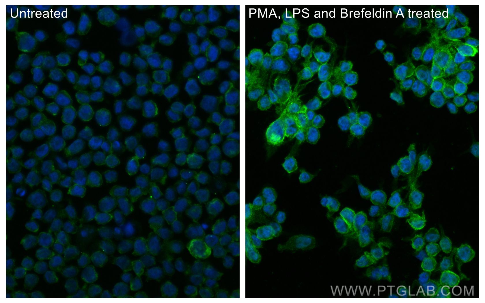 IF Staining of THP-1 using 32190-1-AP