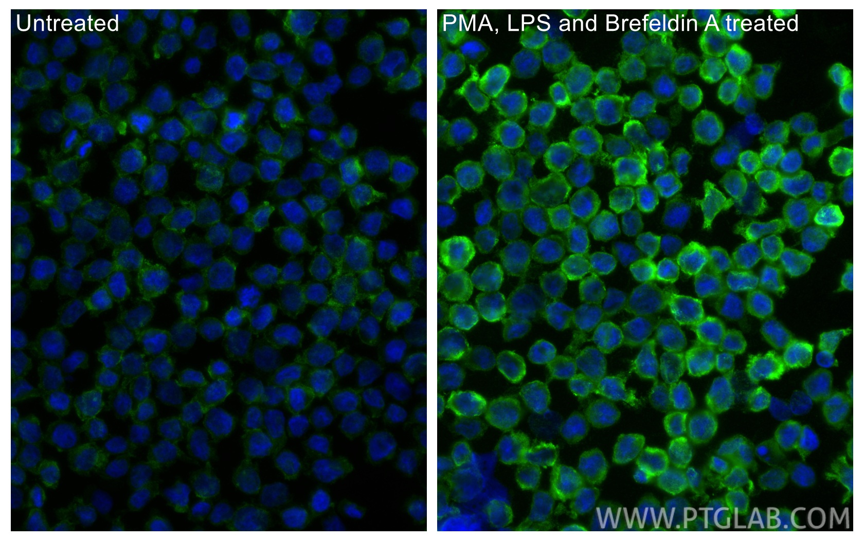 Immunofluorescent analysis of (4% PFA) fixed PMA, LPS and Brefeldin A treated THP-1 cells using CCL4/MIP-1 beta antibody (26614-1-AP) at dilution of 1:200 and CoraLite®488-Conjugated Goat Anti-Rabbit IgG(H+L) (<a class='green' href='/productredirect?CatalogNo=SA00013-2' target='_blank'>SA00013-2</a>). IF Staining of THP-1 using 26614-1-AP