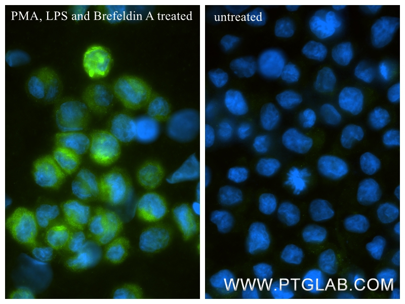 IF Staining of THP-1 using 87376-1-RR (same clone as 87376-1-PBS) IF Staining of THP-1 using 87376-1-RR (same clone as 87376-1-PBS)