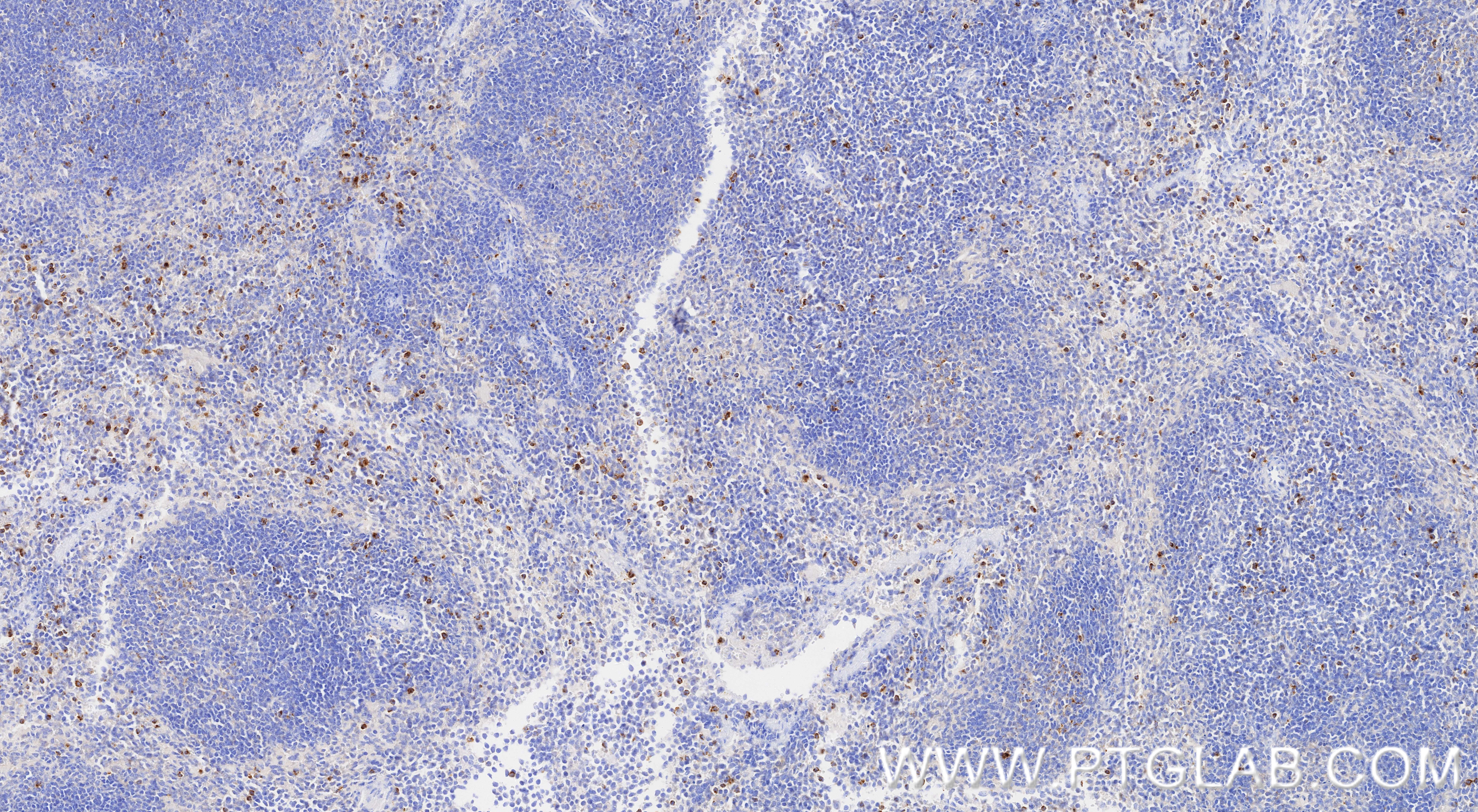 IHC staining of mouse spleen using 87060-4-RR IHC staining of mouse spleen using 87060-4-RR